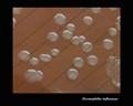 haemophilus influenzae
